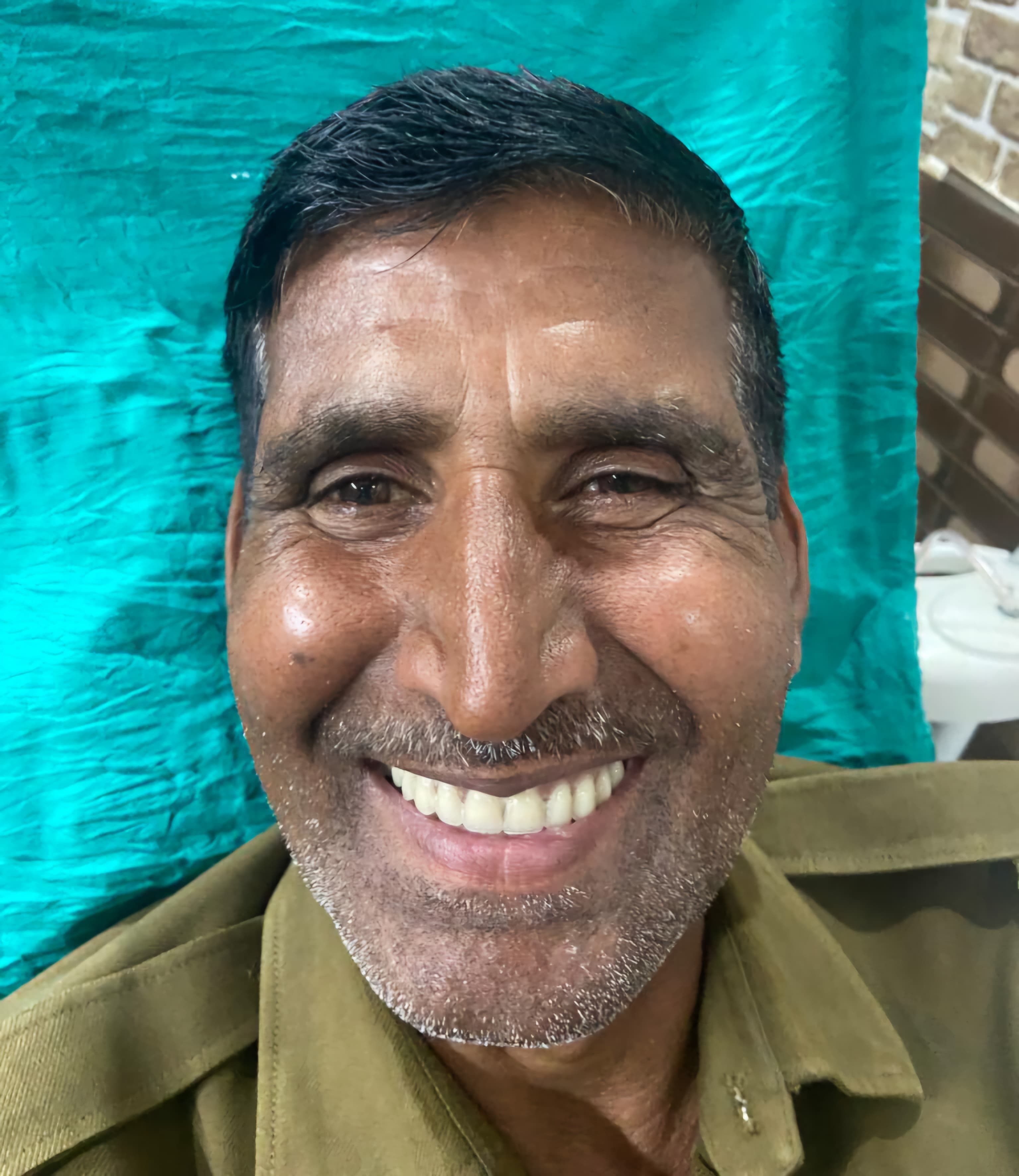 Dental Implants After